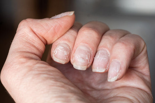 Why Are My Nails Weak and Brittle? Causes, Fixes & Best Nail Growth Solutions